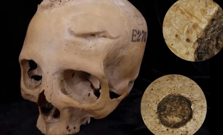 Antik Mısır’da kanser tedavisi: En eski ameliyat kalıntıları bulundu